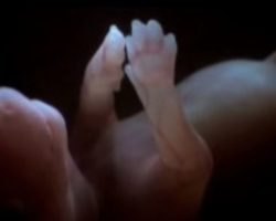 (Video) Watch a Baby Doggy Fetus Inside a Mother’s Womb – I’ve Never Seen Anything Quite Like This Before!